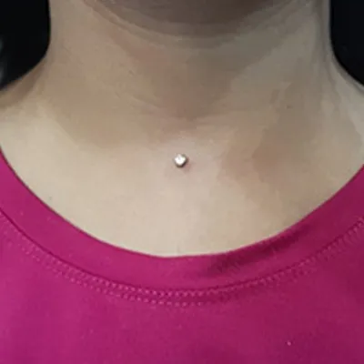 clit piercing